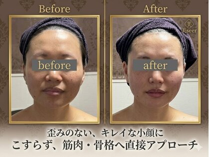 小顔アンドエイジングケア専門店 ビゼ(美sser)の写真