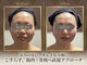 小顔アンドエイジングケア専門店 ビゼ(美sser)の写真