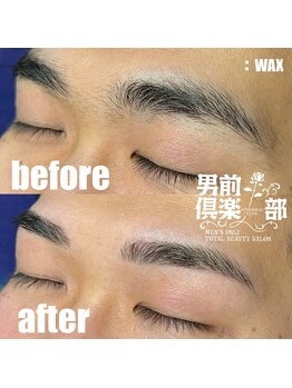 男前倶楽部/脱毛/メンズ脱毛/メンズ専門店
