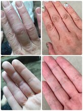 ルリアン(Le lien)/自身のbefore after