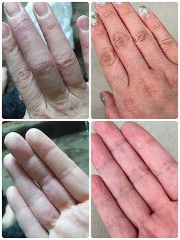 ルリアン(Le lien)/自身のbefore after