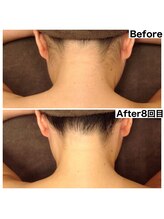 ヴィシア(VIXIA)/お客様のビフォーアフター♪