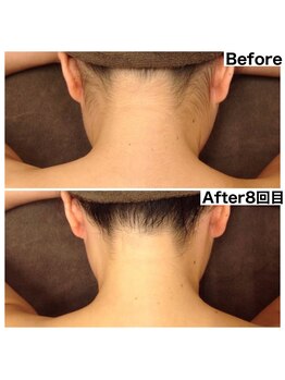 ヴィシア(VIXIA)/お客様のビフォーアフター♪