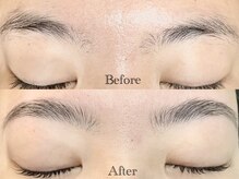 アイル(eye'll)/Hollywood brow lift