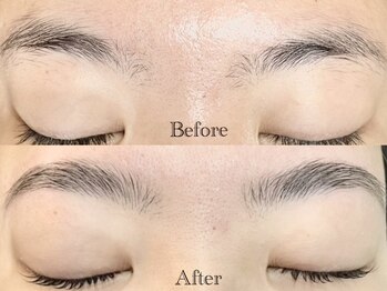 アイル(eye'll)/Hollywood brow lift