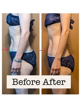 リリー(lily)/上半身スリム