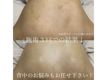 シャルメール 堀江(Charmer)の写真