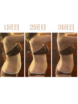 サロンドゥードゥー(SALON DOUDOU)/3回でマイナス6ｃｍ！