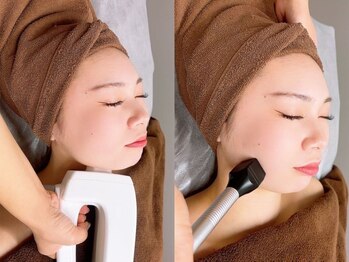 ルディラ 横浜店の写真/韓国で話題の小顔術で圧倒的小顔に！たるみも改善、シャープな輪郭に [インモードFX+FORMA￥13000]
