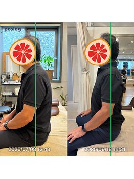 グレフル鍼灸接骨院 整体院 心斎橋/整体/肩こり/マッサージ/腰痛