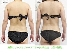 ビューティサロン オハナ(ohana)/筋膜リリースのビフォーアフター