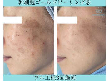 リメイククリニカルビューティー(Remake clinical beauty)/