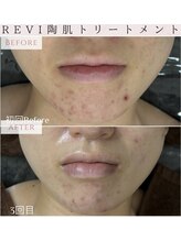 ルリエベル(Relier Belle)/継続が大切です。