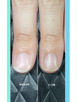 クーラ アンド ベリッシモ(Cura&Bellissimo)/爪先がお辞儀