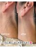 《3周年クーポン》【後ろ姿美人】うなじwax+高保湿ケア付き 8月末まで!