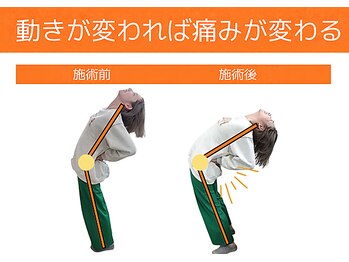 なんぽの写真/【え？まだ、マッサージしてるの？】揉み返しで整体が怖い、マッサージでは効果がうすい人におすすめ！