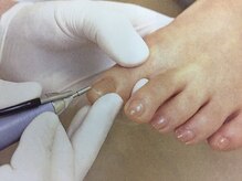 整体アンド足つぼサロン らくだ/足爪のお手入れ