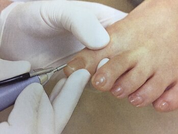 整体アンド足つぼサロン らくだ/足爪のお手入れ