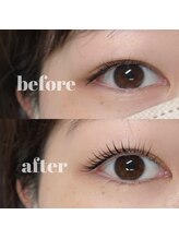 シェヌ(Chez nous)/＊lus lift 