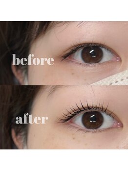 シェヌ(Chez nous)/＊lus lift 