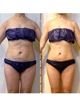 セブンドロップス(7drops)/【６０代女性】代謝が落ちても