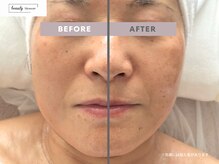 ビューティー ブロッサム(Beauty Blossom)/