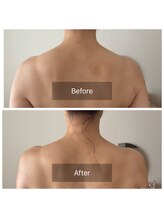 アンフェム(Anfem)/オイルリンパビフォアフ4