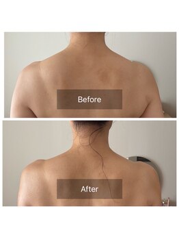 アンフェム(Anfem)/オイルリンパビフォアフ4