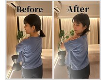 整体ラルース 中目黒(LALUZ)/40代　女性　猫背、巻き肩改善