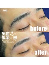 男前倶楽部/脱毛/メンズ脱毛/メンズ専門店