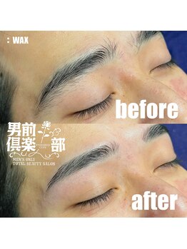 男前倶楽部/脱毛/メンズ脱毛/メンズ専門店