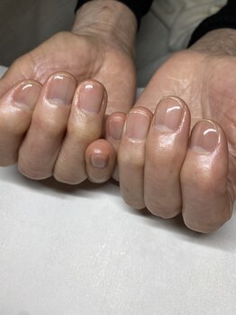 レイ(Rei)/80代の女性*ハンドケア