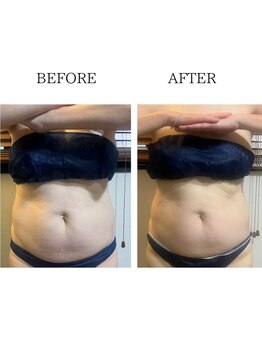 ワン ストレッチ(ONE stretch)/【サイズダウン】