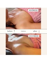 エミニナル(EMININAL)/【バストケア】ビフォーアフター