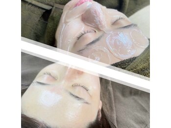 なないろカイロプラクティック院の写真/スキンケアだけでなく”受け取れる肌”に整える事が美肌への近道。WAX脱毛の域を超えた肌質トリートメント!
