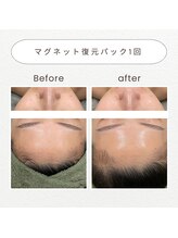 ノドカ 新市街店(NODOKA)/ツヤのあるつるんとした卵肌に