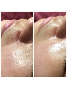 スリリアン 銀座/★お客さまビフォーアフター★