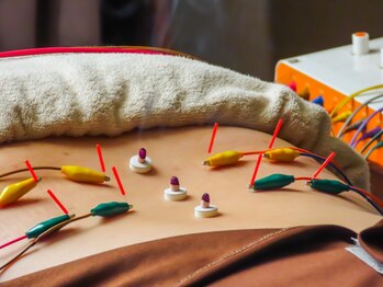 灸スタイル 掛川本院(灸Style)の写真/全身の疲れ、自律神経の不調には「お灸+マッサージ」で根本から改善。