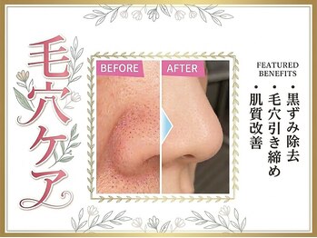 トウメイコガオ 横浜店の写真/毛穴詰まり・汚れを取り除き、つるつる美肌へ☆毛穴が目立たなくなる感動体験！