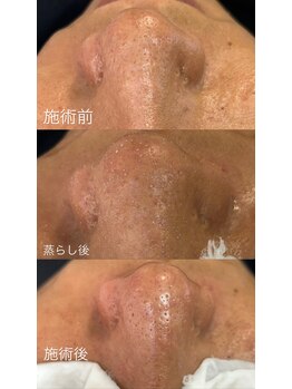 ベベ(bebe)/油分多めのお客様