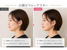 ベアフット(BARE FOOT)/横顔マイナス5cm