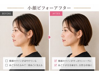 ベアフット(BARE FOOT)/横顔マイナス5cm