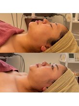 シュシュ(Chou chou)/泉佐野エステ　小顔　セルマン