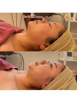 シュシュ(Chou chou)/泉佐野エステ　小顔　セルマン