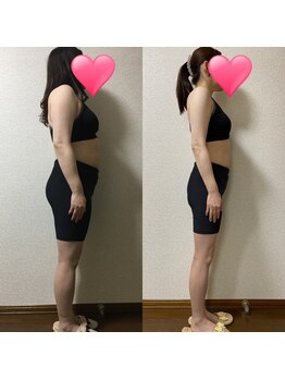 にこ鍼灸治療院/短期集中コースのあるサロン