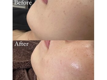 シェリ(Cheri)/フェイスワックスで艶肌♪