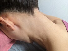 エピコ(EPICO)の雰囲気（しっかり当て漏れのない満足な脱毛を心掛けております。）