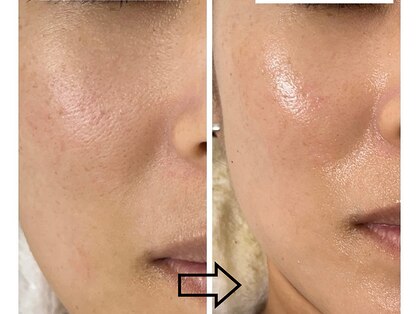 ココ(COCO)の写真