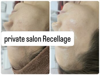 リセラージュ(Recellage)/潤艶フェイスワックス/水光肌へ