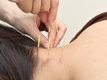 柚香鍼灸院の写真/歴10年以上の鍼灸師による本格鍼灸！疲労や不調はもちろん、婦人科のお悩み、美容まで幅広く対応いたします